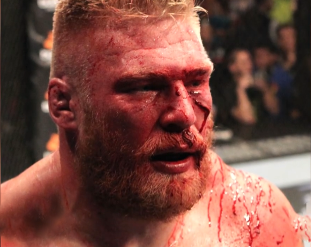 整容院长凯恩约战WWE冠军布洛克莱斯纳声称再给你脸上一道疤
